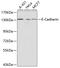 Cadherin 1 antibody, 13-141, ProSci, Western Blot image 