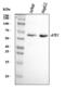 Arginyltransferase 1 antibody, A07459-1, Boster Biological Technology, Western Blot image 