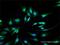 Unc-51 Like Kinase 4 antibody, H00054986-D01P, Novus Biologicals, Immunofluorescence image 