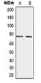 ADAM Metallopeptidase Domain 10 antibody, LS-C351790, Lifespan Biosciences, Western Blot image 