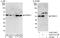 Proteasome 26S Subunit, Non-ATPase 11 antibody, A302-751A, Bethyl Labs, Western Blot image 