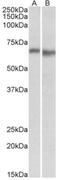 Protein Kinase AMP-Activated Catalytic Subunit Alpha 2 antibody, NBP1-52073, Novus Biologicals, Western Blot image 