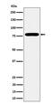 Glutamine--Fructose-6-Phosphate Transaminase 1 antibody, M04341, Boster Biological Technology, Western Blot image 