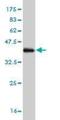 Peptidyl Arginine Deiminase 4 antibody, H00023569-M01, Novus Biologicals, Western Blot image 