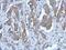 Purinergic Receptor P2X 2 antibody, GTX119003, GeneTex, Immunohistochemistry paraffin image 