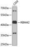 RNA Binding Motif Protein 42 antibody, 19-510, ProSci, Western Blot image 