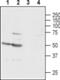 Gamma-Aminobutyric Acid Type A Receptor Gamma1 Subunit antibody, PA5-77410, Invitrogen Antibodies, Western Blot image 