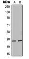 Heat Shock Protein Family B (Small) Member 1 antibody, LS-C358784, Lifespan Biosciences, Western Blot image 