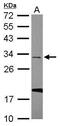 Small Nuclear Ribonucleoprotein U11/U12 Subunit 35 antibody, PA5-31496, Invitrogen Antibodies, Western Blot image 