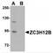Zinc Finger CCCH-Type Containing 12B antibody, MBS150984, MyBioSource, Western Blot image 