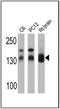 Discs Large MAGUK Scaffold Protein 1 antibody, GTX23437, GeneTex, Western Blot image 