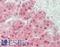 Inositol Polyphosphate-4-Phosphatase Type II B antibody, LS-B13101, Lifespan Biosciences, Immunohistochemistry paraffin image 