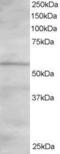 Oxysterol-binding protein-related protein 2 antibody, GTX25921, GeneTex, Western Blot image 
