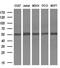 Serine Peptidase Inhibitor, Kunitz Type 1 antibody, M04685-1, Boster Biological Technology, Western Blot image 