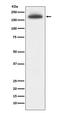 Mannose Receptor C-Type 1 antibody, M02285, Boster Biological Technology, Western Blot image 