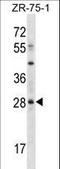 Msh Homeobox 2 antibody, LS-C164657, Lifespan Biosciences, Western Blot image 