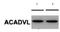 Acyl-CoA Dehydrogenase Very Long Chain antibody, H00000037-M01, Novus Biologicals, Western Blot image 