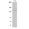 Inositol Polyphosphate-5-Phosphatase D antibody, LS-C386059, Lifespan Biosciences, Western Blot image 