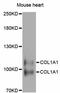 Collagen Type I Alpha 1 Chain antibody, abx125696, Abbexa, Western Blot image 