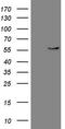 Carboxypeptidase M antibody, LS-C791170, Lifespan Biosciences, Western Blot image 