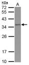 TRNA Methyltransferase 61A antibody, NBP2-20728, Novus Biologicals, Western Blot image 
