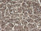 Pyridoxamine 5'-Phosphate Oxidase antibody, M06357, Boster Biological Technology, Immunohistochemistry paraffin image 