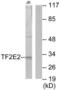 General transcription factor IIE subunit 2 antibody, LS-C118849, Lifespan Biosciences, Western Blot image 