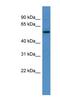 Terminal Nucleotidyltransferase 2 antibody, NBP1-69060, Novus Biologicals, Western Blot image 