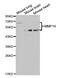 Matrix Metallopeptidase 14 antibody, MBS126829, MyBioSource, Western Blot image 