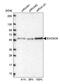 Exosome Component 8 antibody, NBP2-47465, Novus Biologicals, Western Blot image 