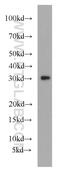 Mitochondrial Ribosomal Protein L28 antibody, 21604-1-AP, Proteintech Group, Western Blot image 