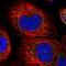 Acyl-CoA Oxidase 3, Pristanoyl antibody, NBP1-85901, Novus Biologicals, Immunocytochemistry image 