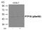 Protein Tyrosine Phosphatase Non-Receptor Type 1 antibody, GTX55423, GeneTex, Western Blot image 