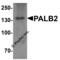 Partner And Localizer Of BRCA2 antibody, 5275, ProSci, Western Blot image 