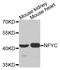 Nuclear transcription factor Y subunit gamma antibody, A9832, ABclonal Technology, Western Blot image 