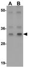 Autophagy Related 3 antibody, GTX85005, GeneTex, Western Blot image 