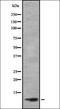 T-cell acute lymphocytic leukemia protein 2 homolog antibody, orb337628, Biorbyt, Western Blot image 