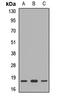 Ribosomal Protein S10 antibody, LS-C667662, Lifespan Biosciences, Western Blot image 