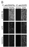 Platelet Derived Growth Factor Receptor Alpha antibody, NBP1-44581, Novus Biologicals, Immunocytochemistry image 