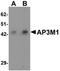 Adaptor Related Protein Complex 3 Subunit Mu 1 antibody, orb75630, Biorbyt, Western Blot image 
