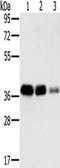 Mitochondrial Fission Regulator 1 antibody, TA350190, Origene, Western Blot image 