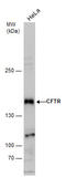 CF Transmembrane Conductance Regulator antibody, GTX129939, GeneTex, Western Blot image 