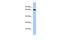 Polypeptide N-Acetylgalactosaminyltransferase Like 5 antibody, PA5-43527, Invitrogen Antibodies, Western Blot image 