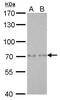 SAM And HD Domain Containing Deoxynucleoside Triphosphate Triphosphohydrolase 1 antibody, MA5-17280, Invitrogen Antibodies, Western Blot image 