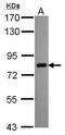 Cleavage And Polyadenylation Specific Factor 3 antibody, GTX116187, GeneTex, Western Blot image 