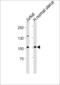 Telomerase Reverse Transcriptase antibody, 57-483, ProSci, Western Blot image 