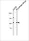 hTERT antibody, 57-483, ProSci, Western Blot image 