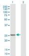 Glutathione S-Transferase Mu 4 antibody, H00002948-B01P, Novus Biologicals, Western Blot image 