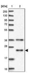 MID1 Interacting Protein 1 antibody, NBP1-84629, Novus Biologicals, Western Blot image 