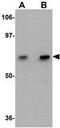 Polypeptide N-Acetylgalactosaminyltransferase 10 antibody, GTX17042, GeneTex, Western Blot image 